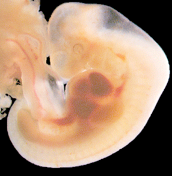Embryo