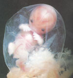 Embryo