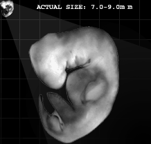 Embryo